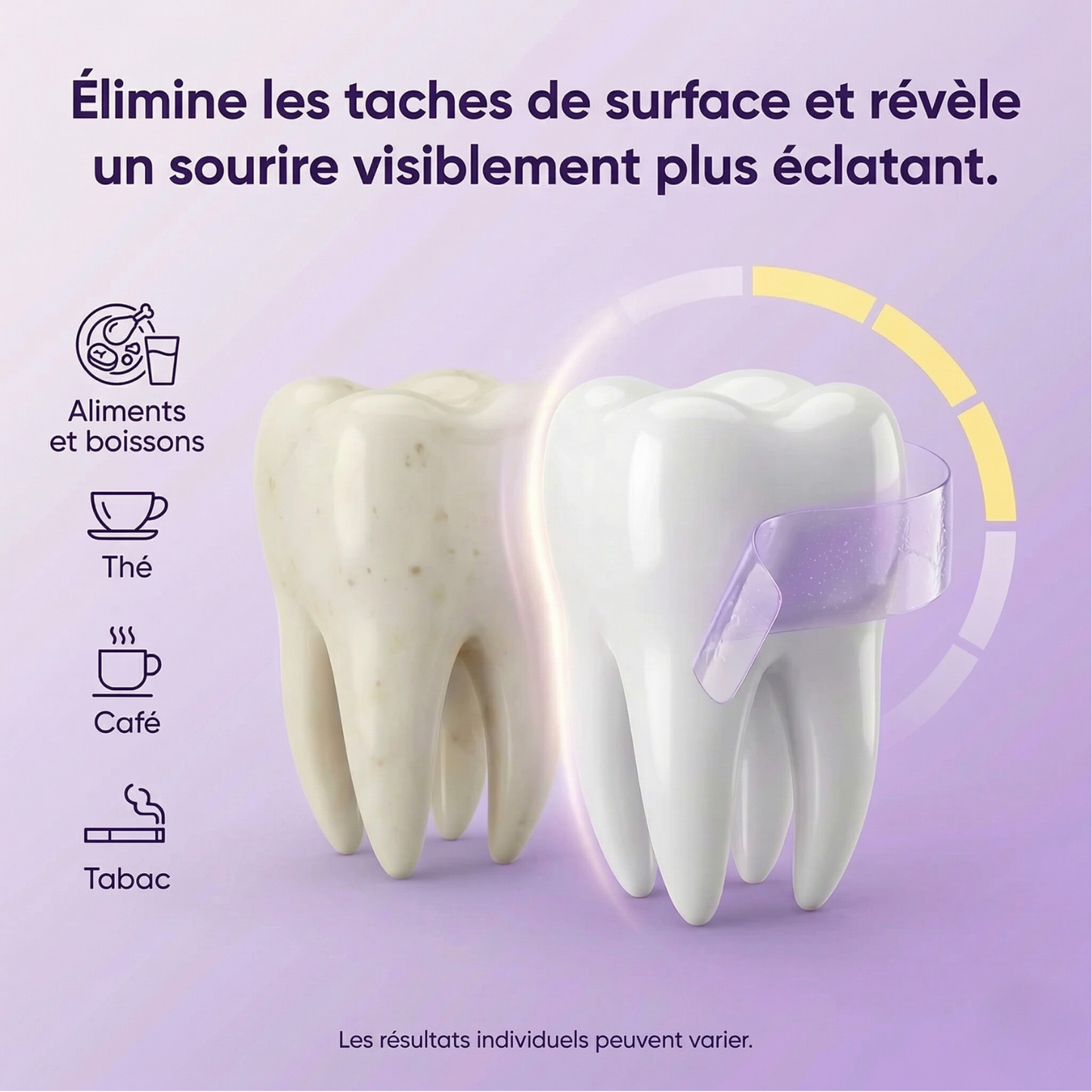 Bande Blanchissante Violette™ – Fraisia Design